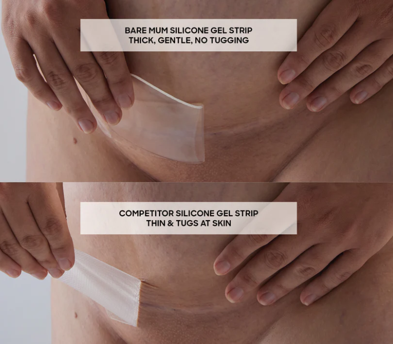 Silicone Gel Scar Strips - Washable & Reusable